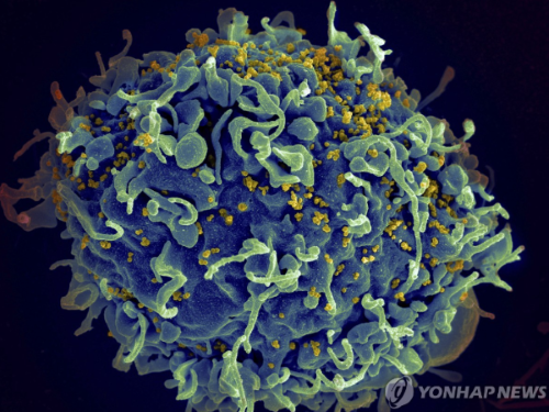 HIV에 공격받는 인간 T세포의 전자현미경 영상 (사진 출처: 연합뉴스)