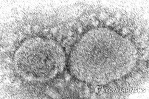 미 CDC가 전자현미경으로 촬영한 신종 코로나바이러스. [미 CDC 제공. AP=연합뉴스]