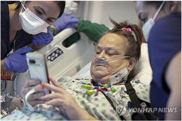 지난 4월 돼지 신장 이식 수술 받은 뒤 리사 피사노씨 모습 (사진 출처: 연합뉴스)