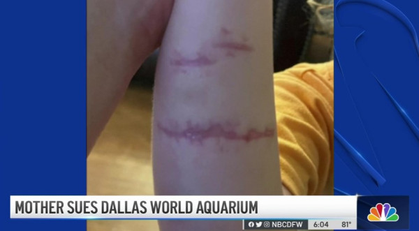 달라스 월드 아쿠아리움의 왕수달로부터 공격받은 네이쓴 윌리엄스 (사진 출처: NBC5)
