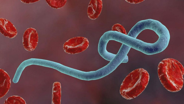 에볼라 바이러스