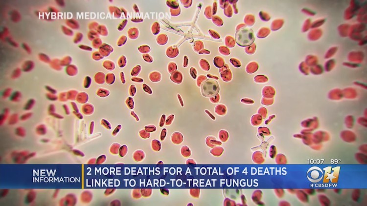 콜린 카운티에서 곰팡이균으로 4명이 사망했다.(사진 출처: CBS DFW)